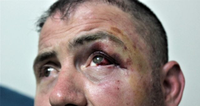 Kuzey Irak gazisini öldüresiye dövdüler