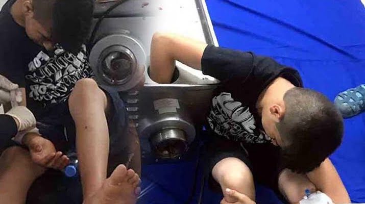 İstanbul’da feci olay! Küçük çocuk elini kaybedebilir