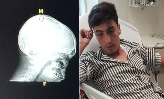 Bayram namazından çıktı yere yığıldı