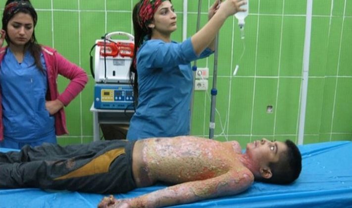 DSÖ ‘beyaz fosfor bombası’ iddialarını noktayı koydu