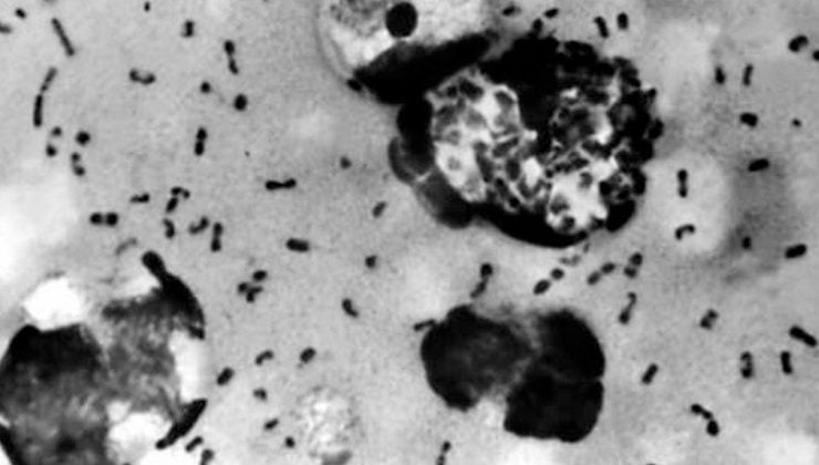 Tarihin en ölümcülü tekrar hortladı! Kara ölüm geri döndü