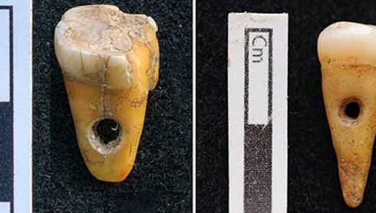 Bilim dünyası şaşkın! Türkiye’deki kazıda bulundu! İnanılmaz diş detayı…