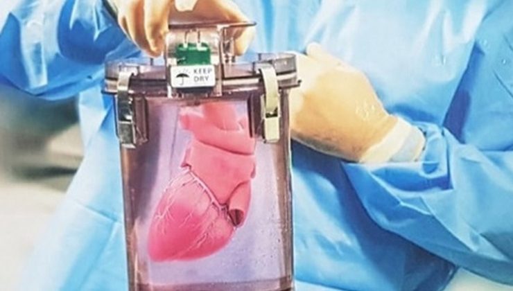 Tıp dünyasında çığır açacak cihaz Türkiye’ye geliyor