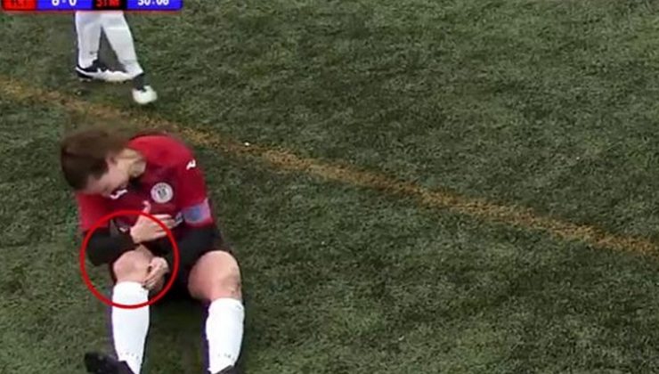 Böylesi daha önce görülmedi! Çıkan diz kapağını yumruklayarak yerine taktı