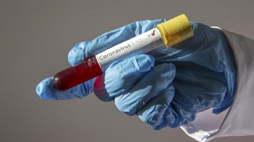 Sağlık Bakanlığı koronavirüste son durumu açıkladı