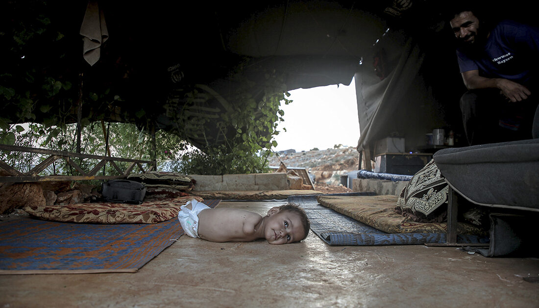 Uzuvları olmayan Muhammed bebek tutunacak bir hayat arıyor