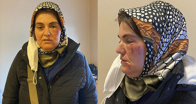 Maltepe Fındıklı’da  Sokak ortasında bir kadın saldırıya uğradı