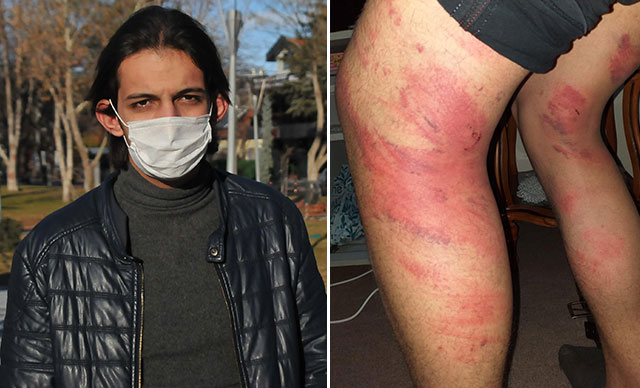 Triger kayışıyla dayak yiyen çırak: Ben dayak yediğimle usta dövdüğüyle kaldı