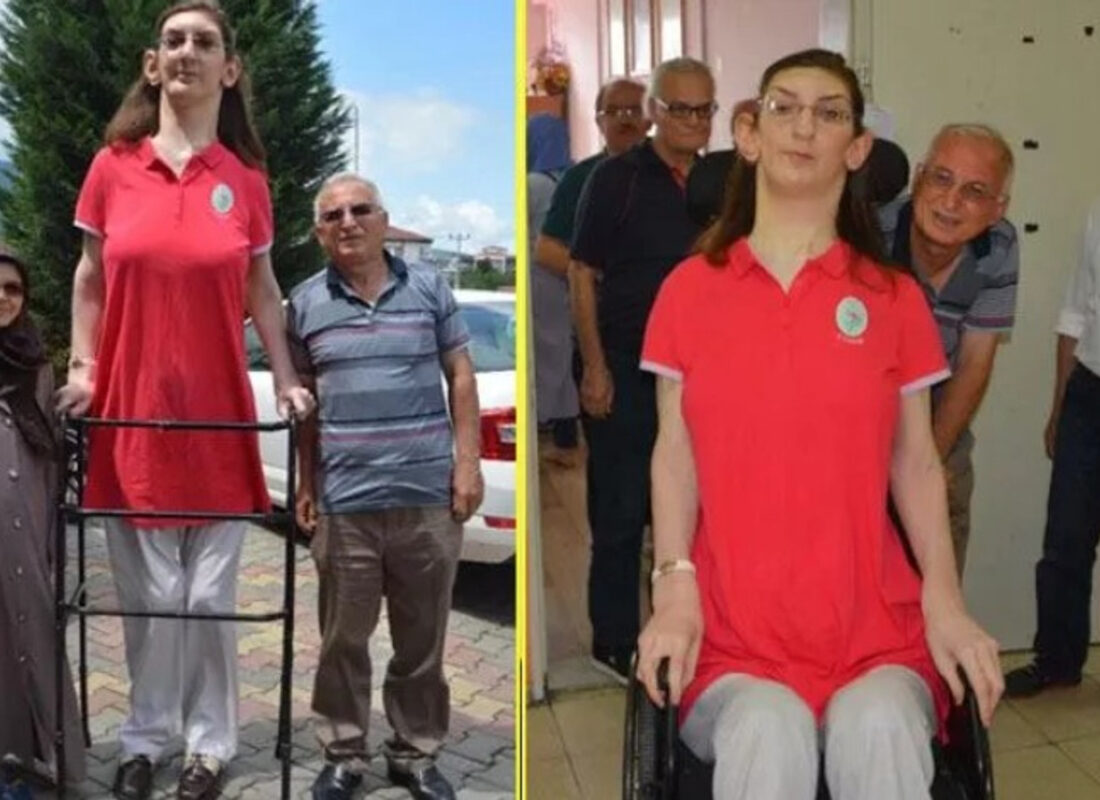 Rümeysa Gelgi, dünyanın en uzun boylu kadını! Guinness Rekorlar Kitabına girdi