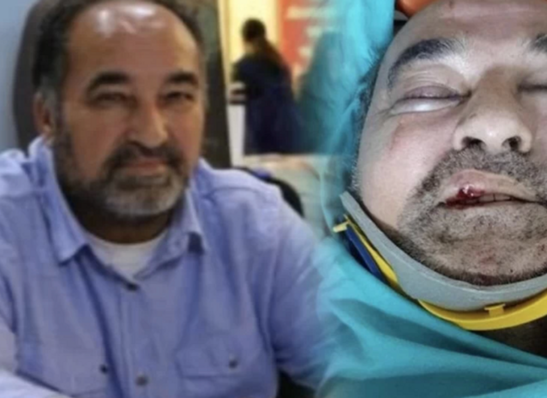 Ergün Poyraz’a saldırıyla ilgili 5 tutuklama