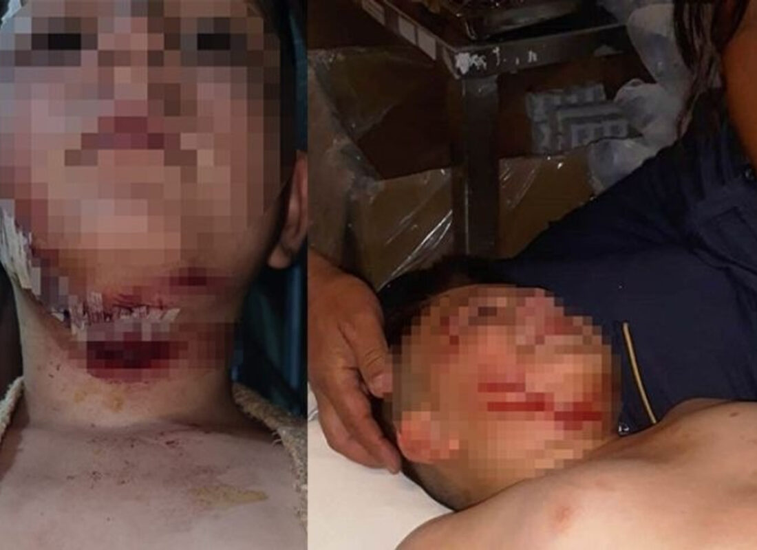 Başıboş köpek dehşeti daha