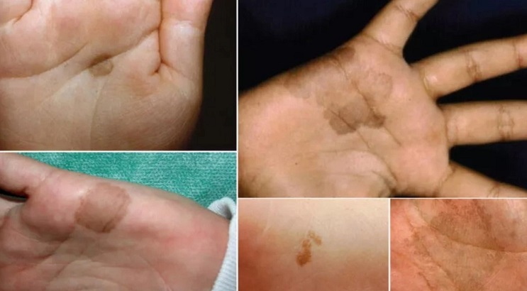 Şeytan kınası neyin habercisi?