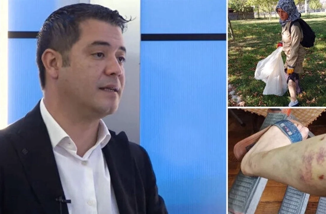İBB Başkan Danışmanı Murat Ongun’un köpeği tarafından ısırılan işçi şikayetçi olunca kovuldu