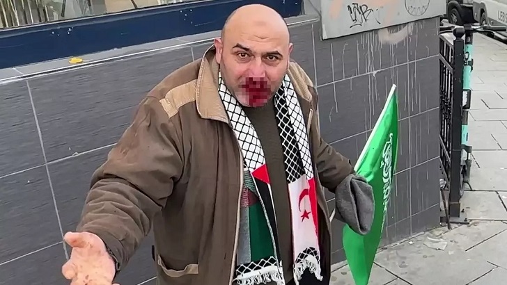 Filistin’e destek yürüyüşünden dönen vatandaşa çirkin saldırı