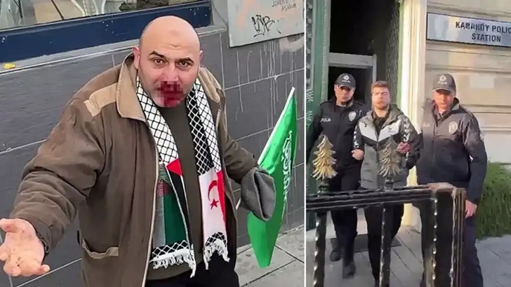 Yumruklu saldırıda bulunan zanlı E.A’nın ifadesine ulaşıldı