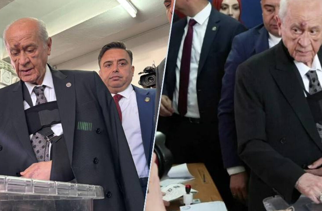 MHP’li Büyükataman’dan Bahçeli’nin yüzündeki morluklarla ilgili açıklama