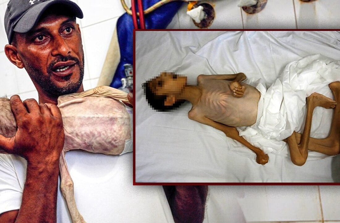 Gazze’de bir çocuk daha açlıktan öldü