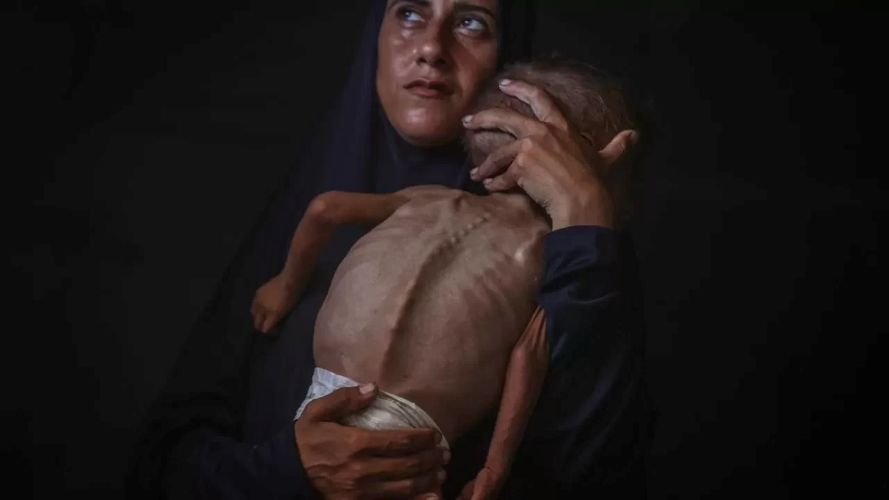 Gazze ve Bir bebek daha açlıktan hayatını kaybetti