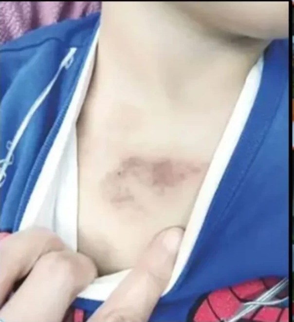 Eyüpsultan’da Kreşte Yaşanan şok istimar iddası